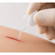 Epiglu Single — tkáňové lepidlo pro rány bez stehů | Harrmed Medical