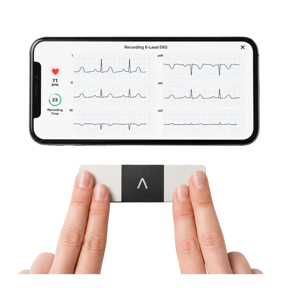 KardiaMobile 6L — osobní EKG s AI | Harrmed Medical